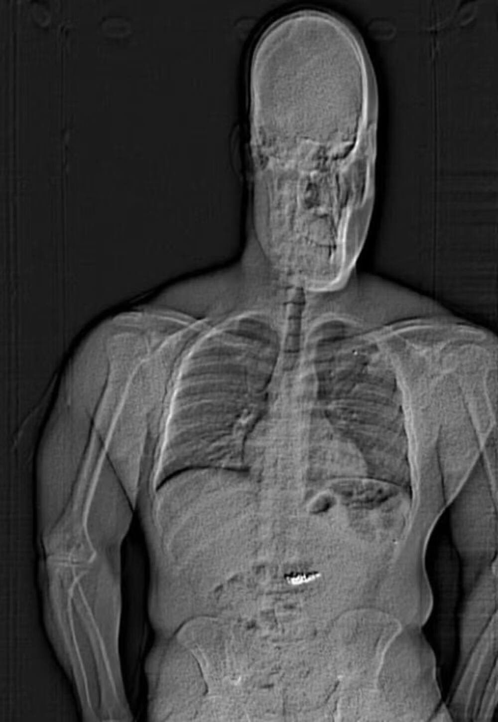 Durante a prisão, o homem questionou: "Vou ser acusado pelo que está no meu estômago?"