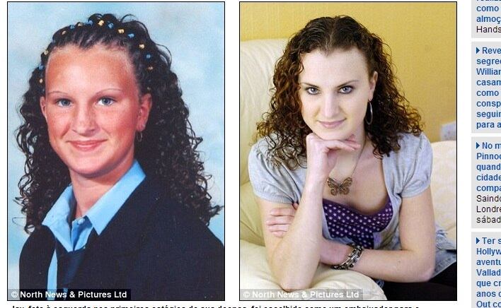 Jay foi eleita embaixadora do Eating Disorder
Association com 18 anos