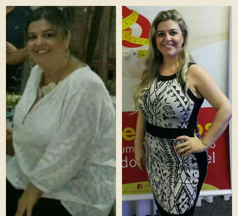 O crescimento do número de obesos no mundo mostra que o tema continua a ser um desafio para a ciência, mas estudos indicam que, para uma pessoa superar o ganho de quilos a mais, é necessário que seu metabolismo seja modificado a partir de uma espécie de reprogramação no cérebro, voltada a hábitos alimentares. Uma das alternativas com este conceito foi utilizada pela fisioterapeuta Edivana Poltronieri (foto), especializada na área dermatofuncional. Veja a seguir!