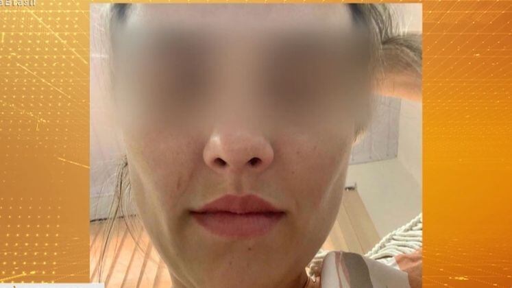 Muitas pessoas têm optado pelo procedimento, que é irreversível, mas os relatos pós-cirurgia têm sido negativos