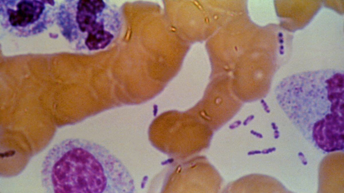 Sintomas aparecem em até duas semanas após a exposição