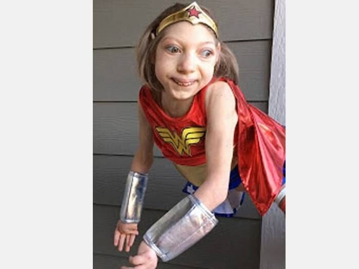 Claire foi diagnosticada quando tinha três meses de vida e a
condição de Lola foi descoberta ainda na gravidez
+ Médicos fazem cesárea de emergência e não encontram bebê
+ Acesse R7 Play e assista às íntegras do Hoje em Dia! Clique e experimente de graça!