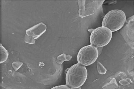 Bactéria aproveita feridas para se instalar no corpo dos pacientes