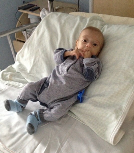 Quase metade
da vida de Chico aconteceu dentro de hospitais. Segundo Jéssica, a primeira vez
que ele recebeu alta foi após completar um ano de idade. Depois dos dois anos,
o menino passava três, quatro meses no hospital, e o restante do ano em casa. Somente
há pouco tempo ele começou a comer comida pela boca.
— Como ele
ficou muito tempo no hospital sem comer, ele adquiriu aversão à comida. Ele foi
liberado para experimentar os alimentos, mas não consegue porque tem muita náusea
e não sente prazer em comer. Ele só coloca na boca pizza e biscoito de polvilho