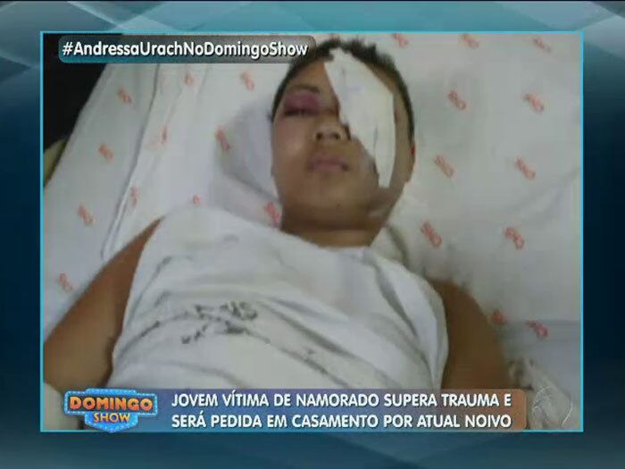 Os médicos disseram que Aline tinha 10% de chance de viver. Ao todo, foram quatro balas na cabeça e duas no braço. A jovem ficou cega do olho esquerdo e passou por 14 cirurgias.


— Minha mãe chegou, sentou do meu lado e falou: "Você está sem o seu olho. Você perdeu sua visão". Fiquei chateada porque era um sonho que eu tinha de ser modelo. Eu me envolvi com a pessoa errada e não sabia

+ Andressa Urach agradece oportunidade no Domingo Show e fala sobre novo quadro
+ Andressa Urach conversa com jovem que se recuperou após ser quase morta pelo ex
+ Assista às íntegras do Domingo Show quando e onde quiser!