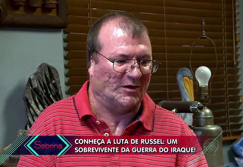 — Um pouco, mas não tanto, pois estávamos treinados e aprendemos a lidar com a situação

+ VÍDEO: Após amputar braços e pernas, jovem brasileiro leva nova vida nos EUA
+ Filho de Hudson ganha look de guitarra e pai torce: “Se meu filho for músico, vou ficar muito feliz”
+ Assista às íntegras do Programa da Sabrina no R7.com/Play!
