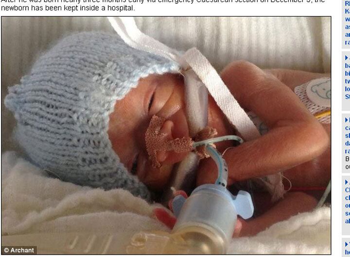 Segundo o jornal Daily Mail, Sarah desenvolveu pré-eclâmpsia
— problema grave caracterizado pelo aumento da pressão arterial durante a
gravidez. Por causa da doença, ela poderia ter morrido quando deu à luz
Milagre: bebê nasce prematura com menos de 1/2 kg e sobrevive