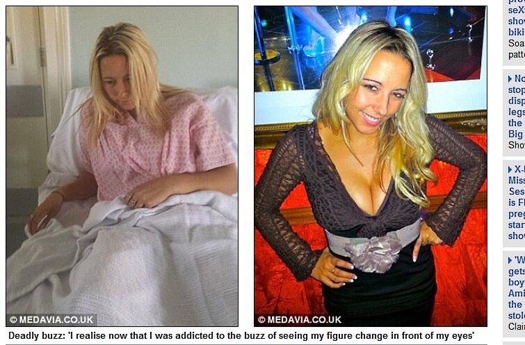 

Durante sete anos, Helen fez a
combinação de pílulas para emagrecer junto com exercícios físicos intensos. Por
causa disso, começou a perder peso e a ganhar músculo. 



— Me senti mais forte e mais leve



Longas viagens podem levar à trombose e outros problemas cardíacos. Saiba como se prevenir