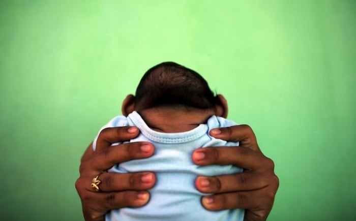 Zika pode ter ligação com caso de microcefalia