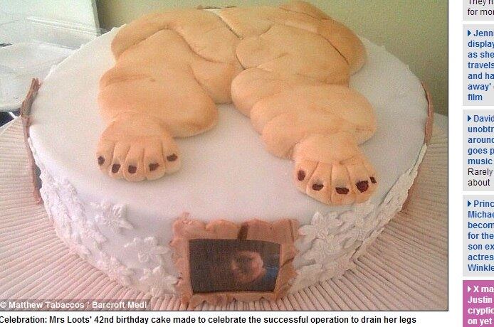 Recentemente, ao lado de sua família e a amiga Margie Grey, Sophia comemorou seu aniversário de 42 anos com um bolo que lembrava as pernas gigantes, antes de serem drenadas