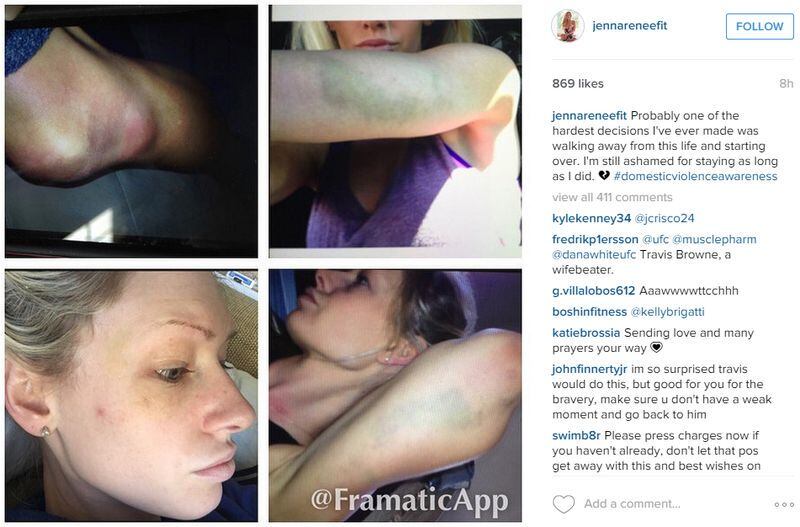 O caso de violência doméstica ocorreu no começo do mês de julho. A fisiculturista publicou uma foto em sua conta do Instagram de alguns machucados pelo corpo. Perguntada por um seguidor se foi o namorado, ela confirmou: "Sim, foi o Travis"