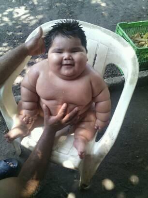 Os pais do menino criaram uma página no Facebook para contar a luta do menino. Eles também abriram uma conta
bancária para receber doações e ajudar a pagar os cuidados
médicos de Luis Manuel 