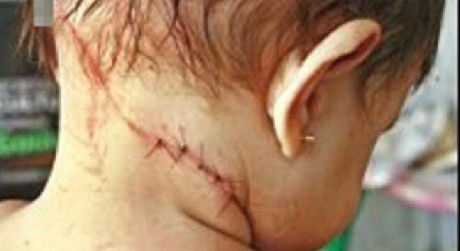 Cerol ou linha chilena mata ou sequela. Governo de São Paula dá dura resposta ao crime