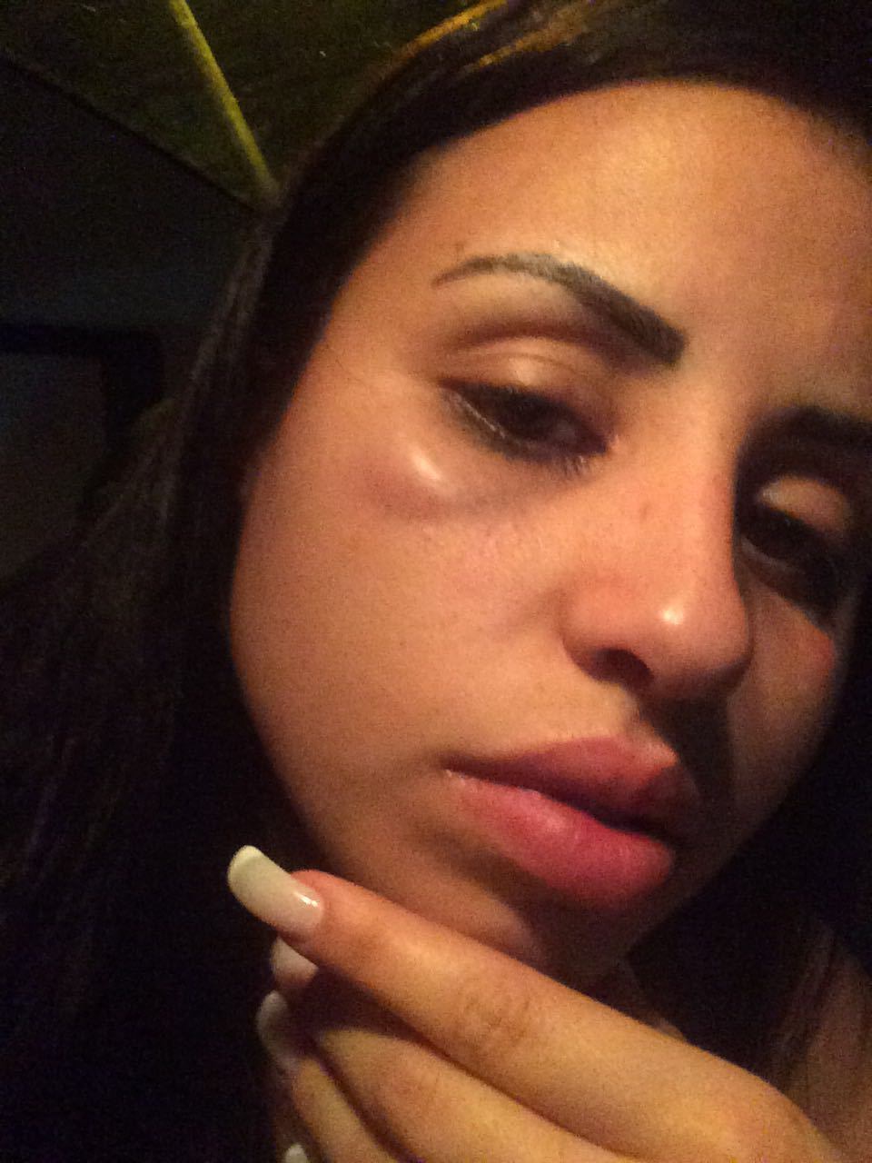 Com hematomas e machucados pelo corpo, Jéssica procurou ajuda médica no hospital Vitória, na Barra, após as agressões. Ela procurou a Deam (Delegacia de Atendimento à Mulher) e foi encaminhada para realizar exames no IML (Instituto Médico Legal).