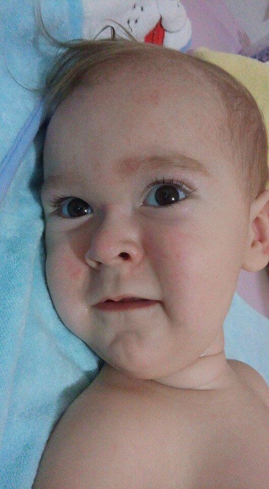 — Essa pesquisa está dando muito resultado, por isso que a
gente está tentando feito louco colocar o Miguel no programa. As crianças que
estão recebendo o tratamento experimental ficam em pé, já andam com ajuda de suporte,
sentam sozinhas, engatinham... têm algumas que já estão até comendo 