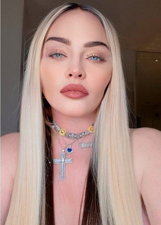 A foto acima, publicada no início de fevereiro, acumula quase 6.000 comentários — a maioria com críticas à aparência artificial da cantora. "Madonna, é tu mesmo?", questionou um seguidor brasileiro. Uma mulher chegou a insinuar que a rainha do pop tinha sido trocada por outra pessoa. "Quem é você? Boa tentativa, mas Madonna era muito mais bonita que você, impostora", afirmou