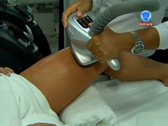 

A celulite não tem cura, mas tem muitos tratamentos. A
drenagem linfática é a mais conhecida

