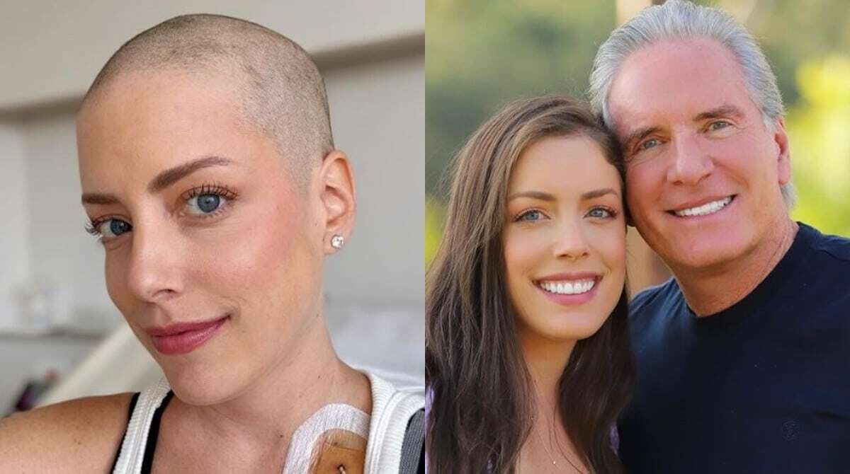 Fabiana Justus revelou que raspou os cabelos