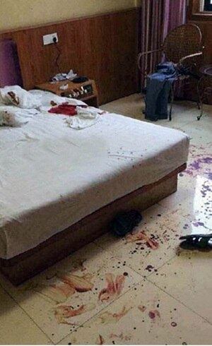 Funcionário do hotel disse que encontrou o pênis decepado em cima da cama