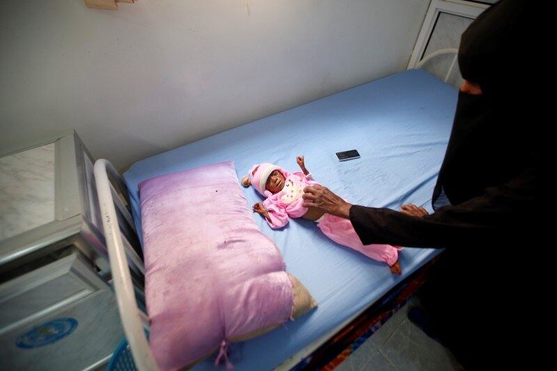 “A fome está aumentando a cada dia e as pessoas já esgotaram todas as suas estratégias de sobrevivência. Milhões de civis não poderão resistir sem ajuda externa”, afirma Hadi