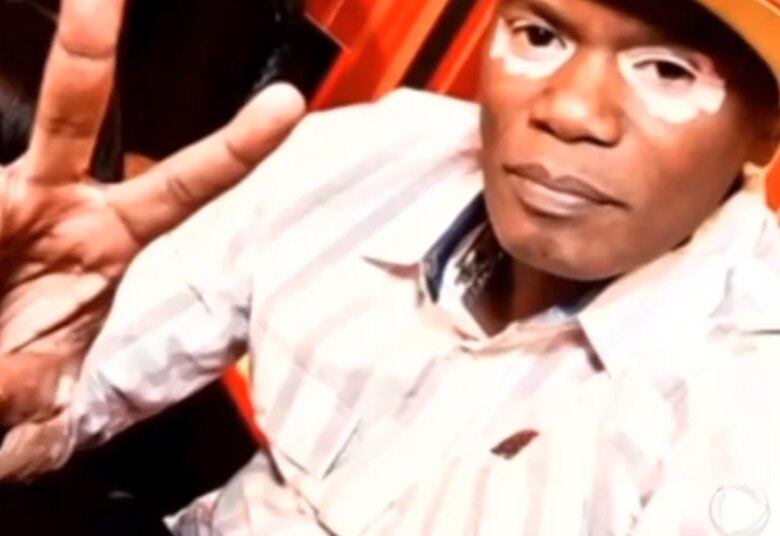 O rapper brasileiro Rappin' Hood exibe a doença sem reservas