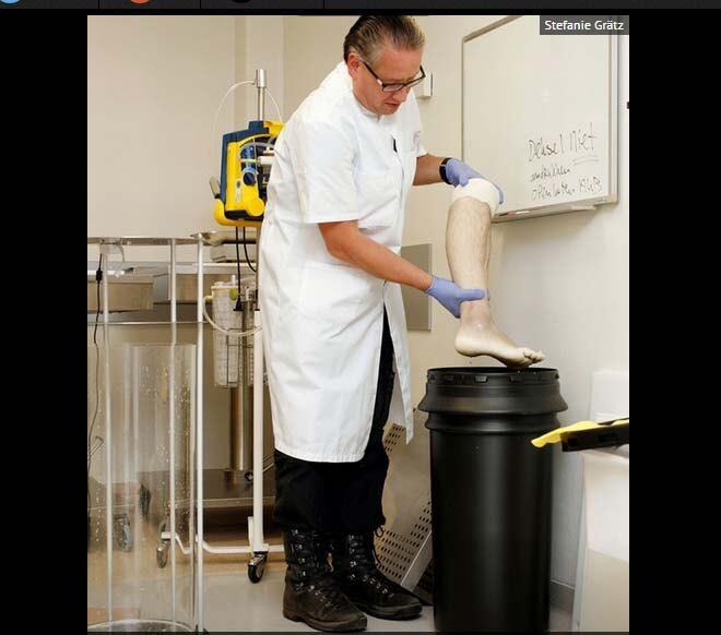 Boten se inspirou depois do acontecido e decidiu transformar seu membro amputado em algo "útil". O holandês consultou um advogado e descobriu que tinha direito sobre a perna que perdeu. As informações são do Mirror