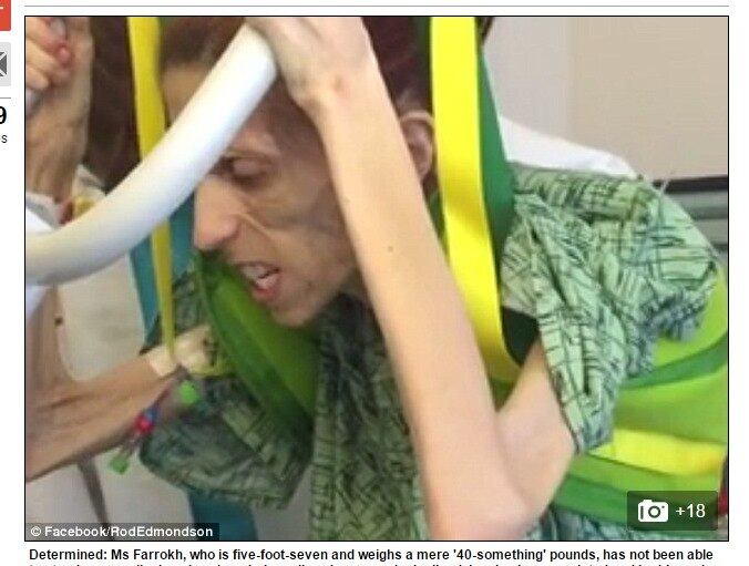 Rod
Edmondson, marido de Rachael que largou o emprego para se dedicar integralmente
aos cuidados da mulher, anunciou a novidade e se disse “animado”