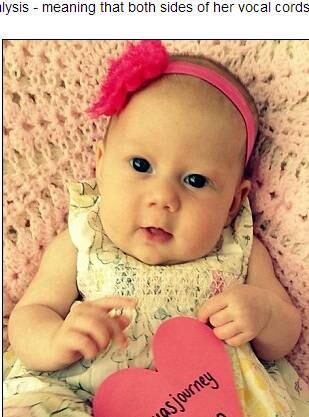 Além do problema nas cordas vocais, Leya teve que ser
submetida a uma traqueostomia nos primeiros dias de vida. Agora, com o
dispositivos em seu pescoço, os pais tentam saber como lidar com a condição de
sua filha para que poderem levar a menina para casa
Doença rara deixa estudante completamente paralisada