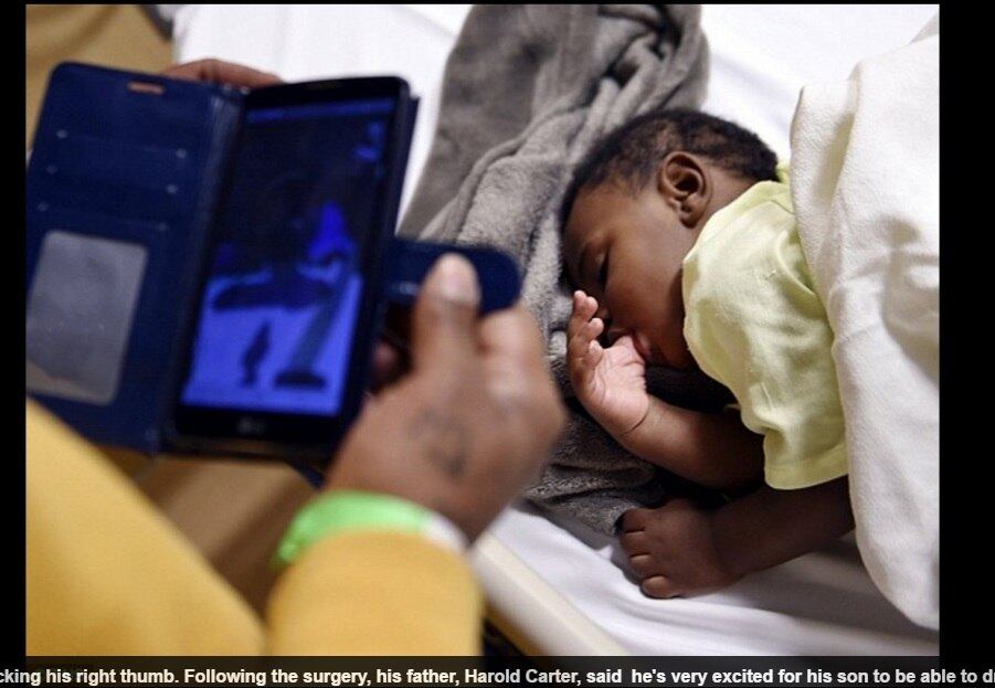 Agora, Kyrie deve fazer fisioterapia para reabilitar as
funções da mão, mas os médicos preveem uma vida normal para o menino