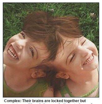 A mãe das garotas, Felicia, conta
que elas adoram ir para a escola, assistir à Power Rangers na TV e comer
diferentes sabores de bolo. Além disso, ela acrescenta que Tatiana e Krista
estão sempre felizes, e que dão a ela e ao pai, Brendan, muita alegria
diariamente. A família tem, ainda, outros três filhos: Rosa, de 11 anos,
Christopher, nove, e Shayleigh, cinco.



— Ver tudo que tenho que passar com
elas enlouqueceria qualquer um. É muito difícil, mas eu não desejaria nada
diferente para mim. Se eu pudesse escolher, escolheria viver exatamente desta
maneira

 