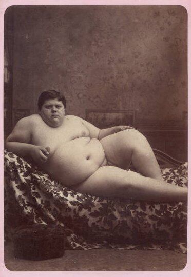 No Estado de Michigan, por exemplo, foi criada uma lei que proibia qualquer "exibição de um ser humano com deformações, exceto com propósitos científicos"
