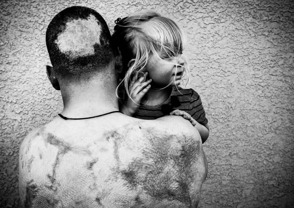 “Ouvíamos falar ‘este
número de homens foram mortos’ e ‘tantos foram feridos’”, diz Jay, “e nós
pensamos que talvez eles foram baleados, e não temos ideia de como fica uma
pessoa ferida na guerra”.  


O fotógrafo decidiu
visitar o Centro Médico Militar Walter Reed para conhecer e conversar
com os veteranos. Seu primeiro contato foi o capitão Nicholas Vogt, atingido
por um artefato explosivo detonado sob seus pés, no Afeganistão, que quase o
matou. Mas suas pernas tiveram que ser amputadas. 

O veterano Robert
Bernier tem 60% do seu corpo queimado, após ser atingido por uma artilharia. Nesta foto ele carrega sua filha Layla