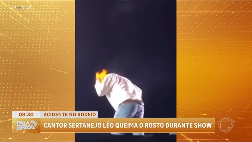 Cantor Léo fica ferido após ter rosto atingido por fogo durante show no interior paulista