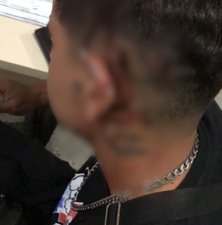 Jovem teve ferimentos na cabeça