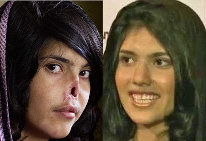 A afegã Aisha Mohammadzai era abusada pela família do marido e obrigada a dormir no estábulo com os animais na casa dos sogros. Aisha tentou escapar de casa, mas foi perseguida e mutilada, perdendo o nariz e as orelhas. Anos depois do ataque, Aisha foi para os Estados Unidos, onde passou por uma cirurgia para reconstrução de seu rosto