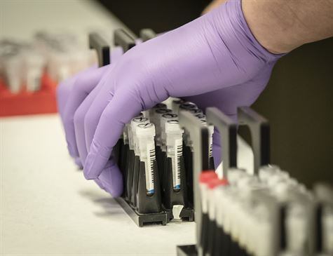 Segundo gestores, os profissionais que estão na frente de trabalho de combate à pandemia estão entre as prioridades