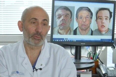 O médico Laurent Lantieri liderou a equipe de cirurgia