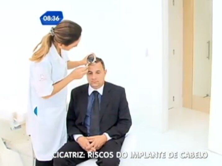 Antes de passar por qualquer procedimento estético, o ideal é pensar muito bem, e procurar um bom profissional
+ Implante capilar: conheça os riscos do procedimento
