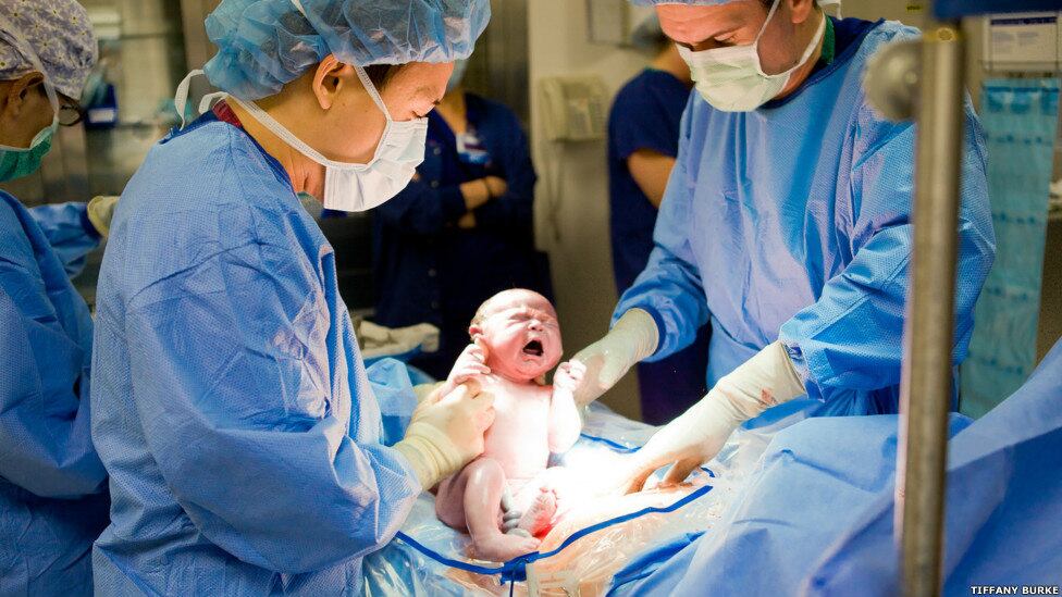 Estados Unidos são um dos países mais caros do mundo quando o assunto é dar à luz