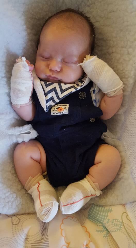 Mesmo com o dia a dia difícil, a mãe do menino explica que
além de achar consolo falando nos fóruns online com outras mães que têm crianças com a mesma doença, ela ainda consegue novas informações e conselhos. 


— As outras mães são incríveis, eu não sei o que faria se não
tivesse encontrado elas