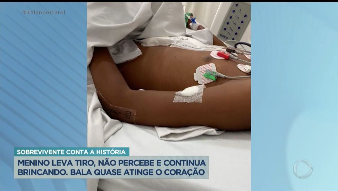 Adolescente passou por cirurgia