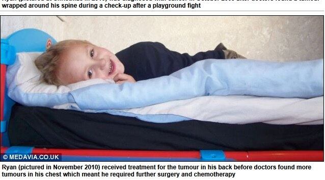 Depois de um tempo, o menino foi submetido a uma nova cirurgia para remover
os tumores, incluindo aqueles que estavam em torno de suas costelas


