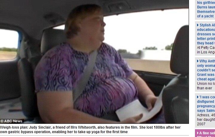 Zsalynn faz parte de um documentário que mostra a saga de três mulheres na luta por perder peso. Judy Sinclair (na foto acima) perdeu 81 kg depois de fazer cirurgia de estômago