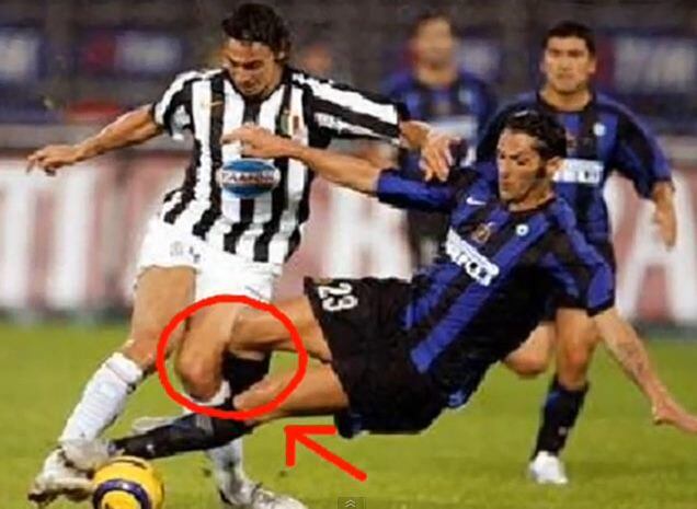 Da velha guarda, daqueles que já pararam, Materazzi é um dos principais nomes dentre os carniceiros do futebol. Basta ver neste lance como ele era "bonzinho" dentro de campo