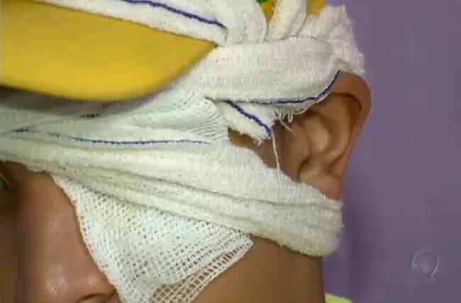 O jovem ferido foi levado ao hospital por parentes dele, mas ficou cego
do olho esquerdo. 
— O médico falou que não teve jeito porque, na hora [do tiro], o meu
olho explodiu