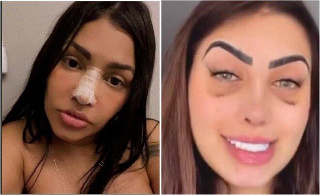 Muitos famosos precisaram pausar suas atividades durante a pandemia da covid-19. Com tempo livre, alguns aproveitaram para realizar procedimentos estéticos e mudar
detalhes que incomodavam na aparência. Rinoplastia, harmonização facial e lipo LAD lideram a lista. Relembre as mudanças em 2020!
