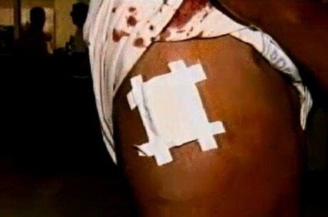 Motivado por ciúmes, um homem pegou um facão e deu vários golpes no rosto da namorada após uma briga em Sabará. Márcia de Araújo Reis levou um corte profundo na face e foi encaminhada para o hospital sem correr risco de morte