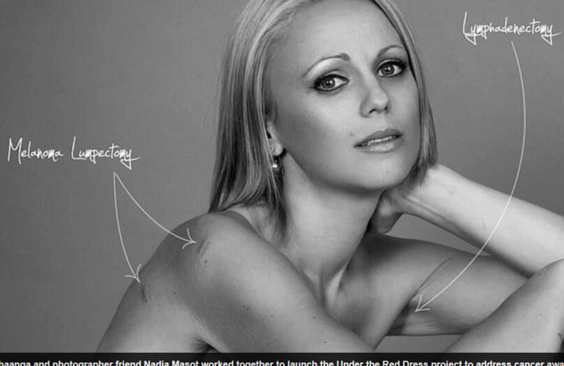 — Me expus
para milhões de pessoas, e se isso foi suficiente para ajudar as pessoas, já terá valido a pena
Modelo usa Facebook como terapia e supera câncer