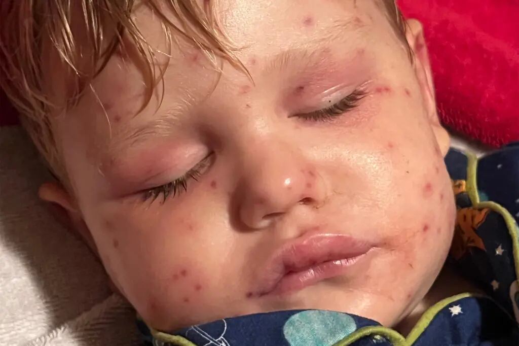 Médicos identificaram falência no coração, fígado e rins da criança