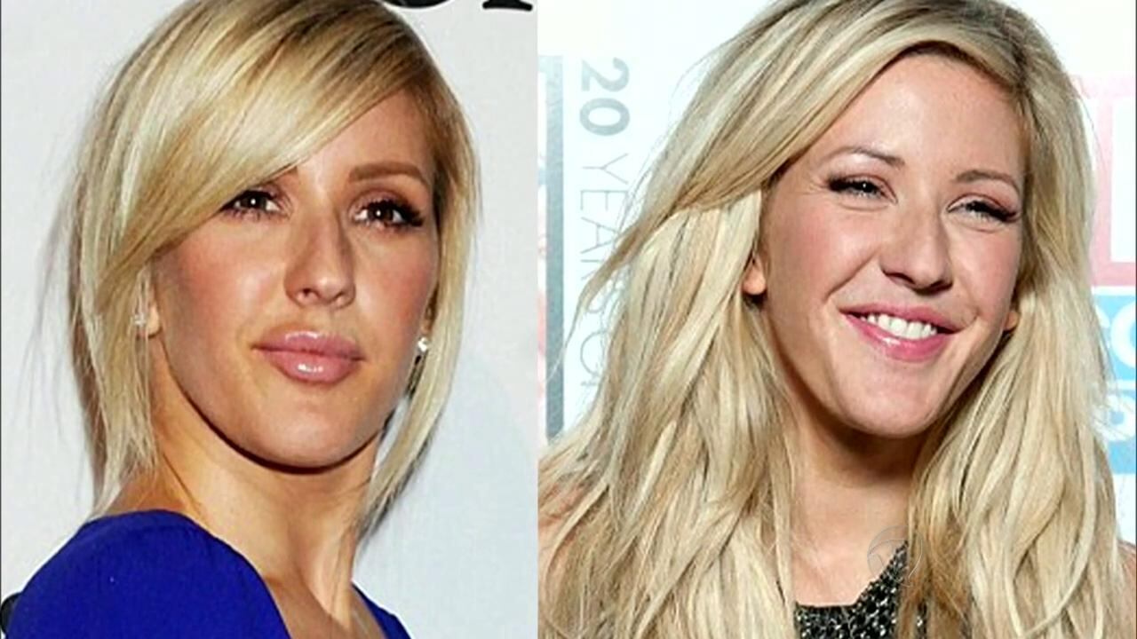 Já no caso da cantora e compositora britânica Ellie Goulding a crítica mais feroz veio de um jornal. 

— O que ela fez com seu rosto? Ellie Goulding espalha preocupação entre os fãs por aparecer com lábios grossos e aparência visivelmente modificada

• Nostalgia dos comerciais: veja como está o menino do brócolis e o mordomo Alfredo
